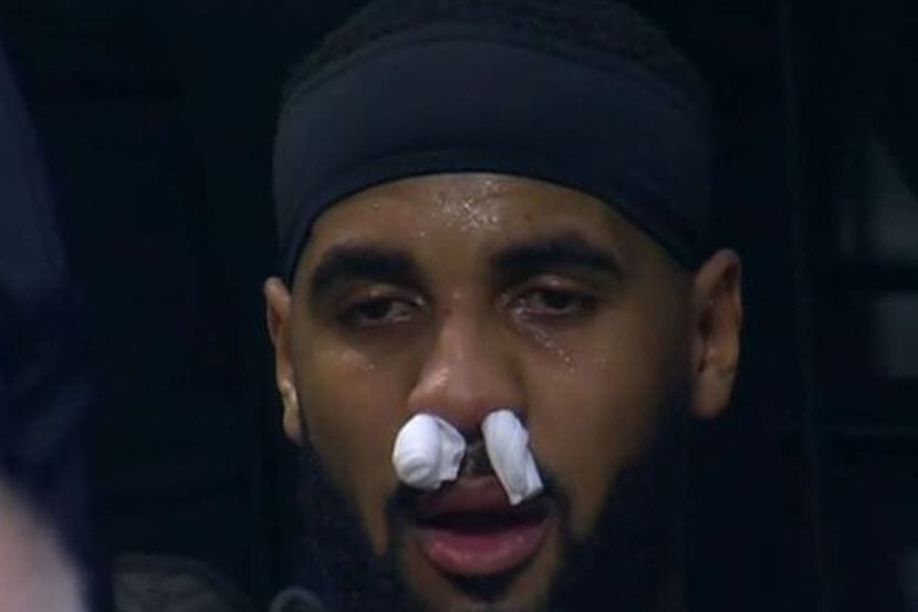 CENTAR CRNO-BELIH POVREĐEN! Bivši igrač Partizana nokautirao Brendona Dejvisa!